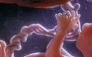 18 неделя беременности