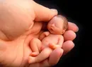 20 неделя беременности