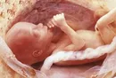 32 неделя беременности