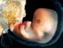 5 неделя беременности