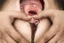 Кесарево сечение: Пять страшных мифов